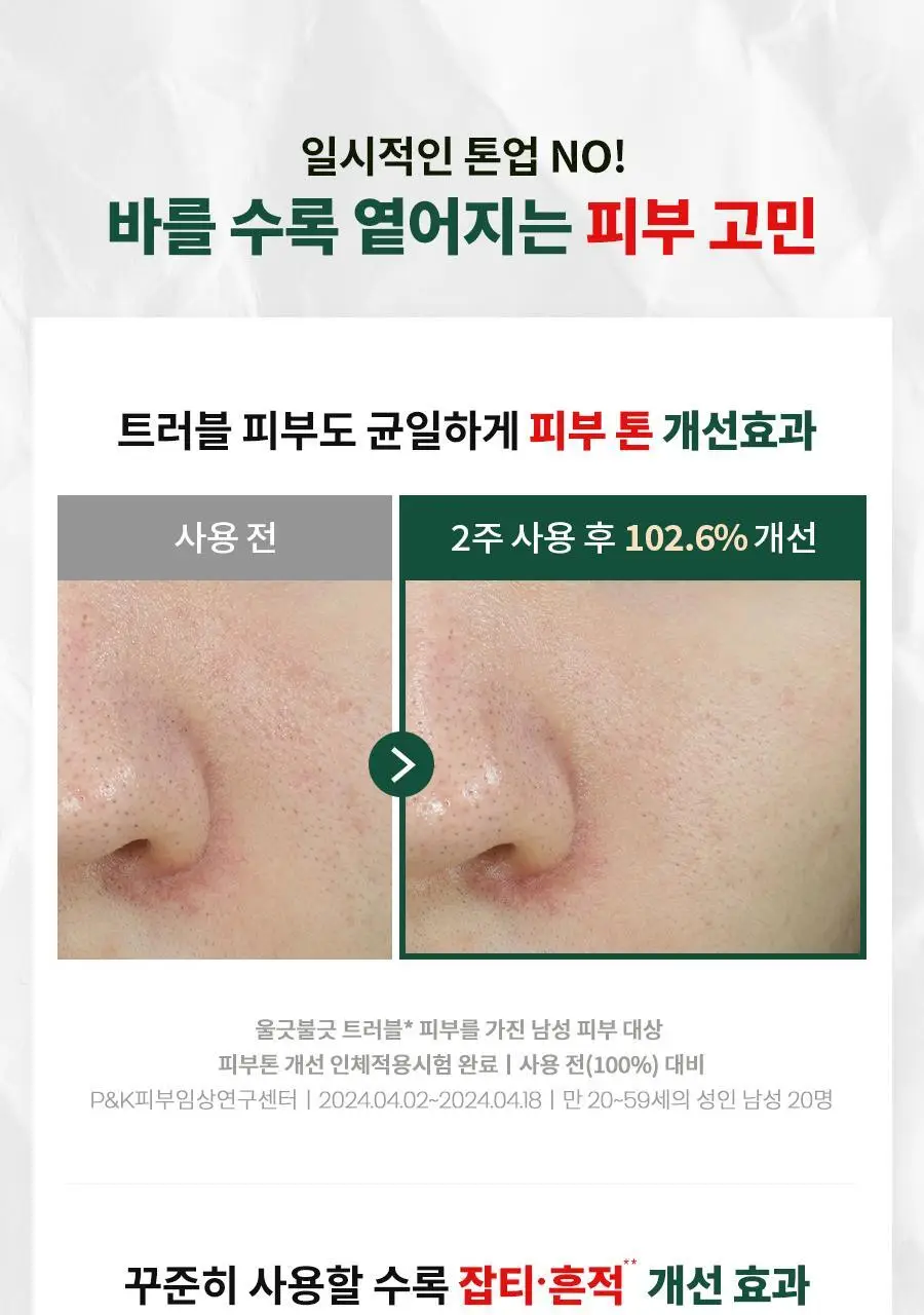 [선케어/반톤업] 닥터지 레드 블레미쉬 포 맨 올인원 톤 로션 50ml 기획 (+젠틀폼 30ml) 상세페이지 32